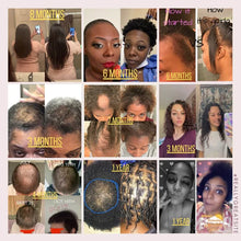 Load image into Gallery viewer, (10 in 1) Hair Growth Oil

