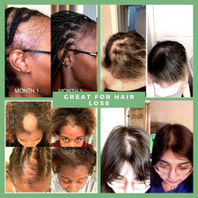 Load image into Gallery viewer, (10 in 1) Hair Growth Oil
