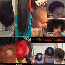 Load image into Gallery viewer, (10 in 1) Hair Growth Oil
