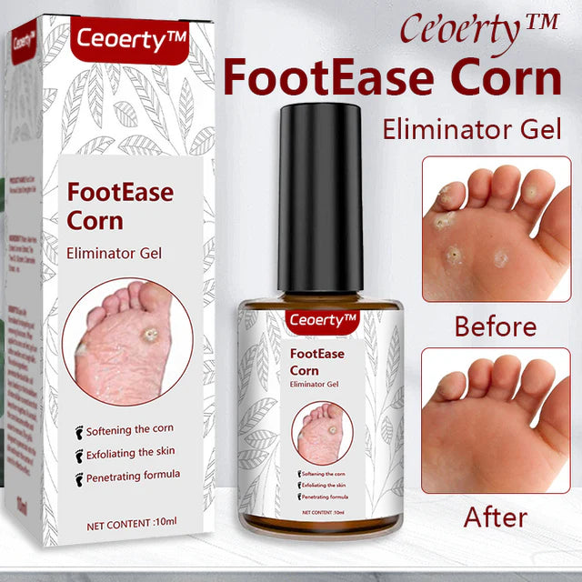 Feet Corn Removal Serum 30ml(Pack Of 1)