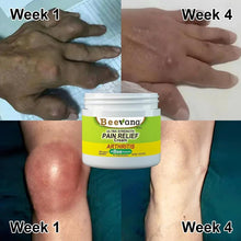 Load image into Gallery viewer, Bee Venom Joint and Bone Therapy Cream (Pack of 1)

