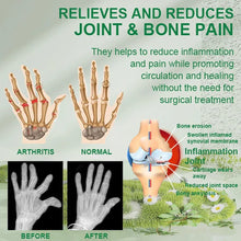 Load image into Gallery viewer, Bee Venom Joint and Bone Therapy Cream (Pack of 1)
