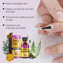 Load image into Gallery viewer, Fungi Free Bee Venom Nail Treatment Solution Serum (15ml)
